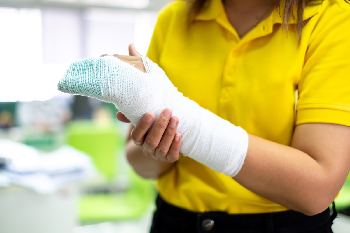 Dallas burn injury attorneys